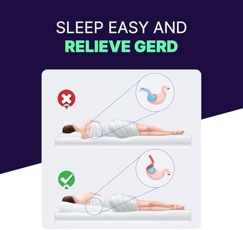Acid Reflux Wedge Pillow for Sleep Sit 1
